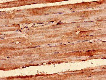 SDHA Antibody